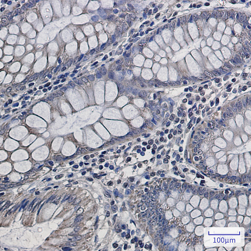 Complex III Subunit 5 Rabbit mAb